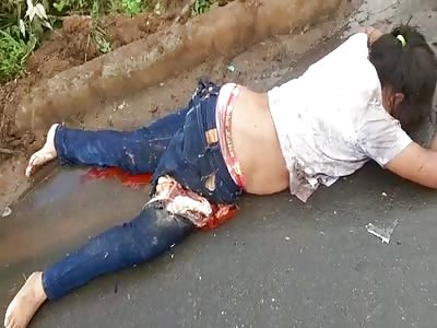 GIRL HAD A SERIOUS ACCIDENT