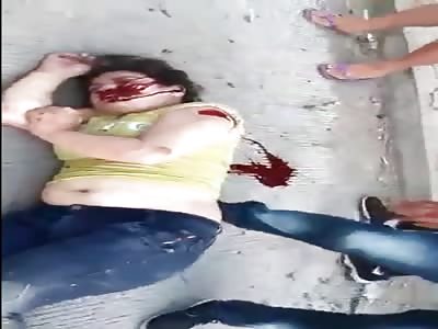 ACCIDENT VICTIM LYING ON THE STREET