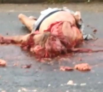 OMG - WOMAN WAS SHATTERED IN AN ACCIDENT