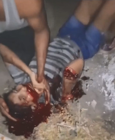 *SHOCKING* GIRL WAS SLASHED WITH MACHETE