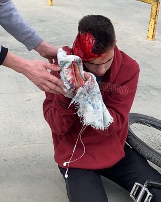 ONLY A SCRATCH ON HEAD