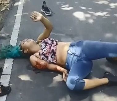 Woman Broken In Accident Screams In Pain