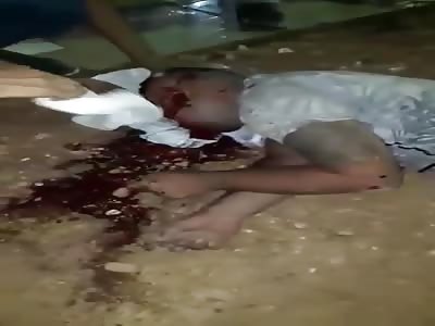 HE WAS SHOT WITH A HANDMADE GUN