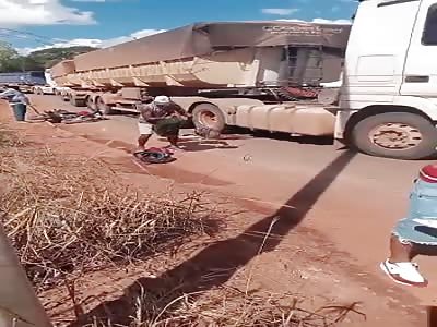 LEG DESTROYED IN AN ACCIDENT 