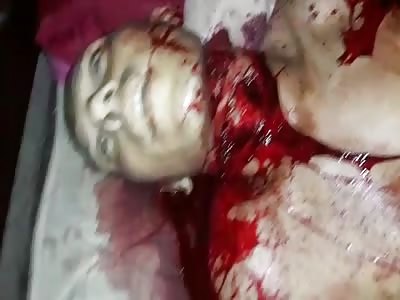 HE WAS PIERCED BY DAGGER