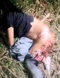 POOR WOMAN SERIOUSLY INJURED IN AN ACCIDENT