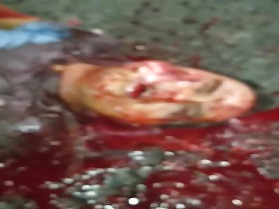 DEAD MAN ON THE STREET