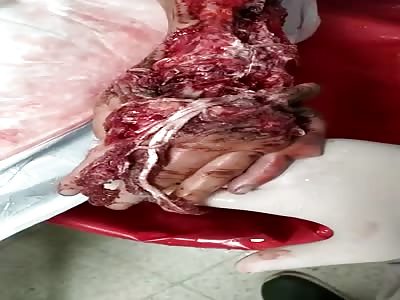 THE ARM AND THE HAND