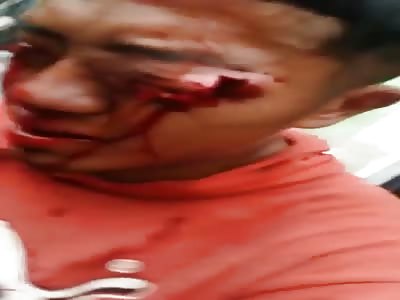 HE HAD HIS EYES PIERCED