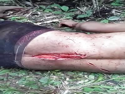 SHORT VIDEO SHOWS MAN WOUNDED BY MACHETE