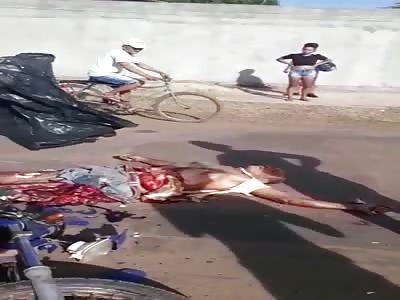 MAN'S SHATTERED BODY AFTER AN ACCIDENT 