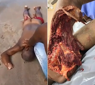 BRUTAL Shark Attack Aftermath