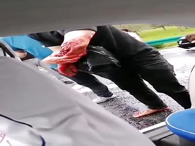 JUST A SCRATCH IN THE ARM