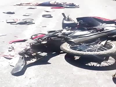 WOMAN LEGS CRUSHED IN AN ACCIDENT