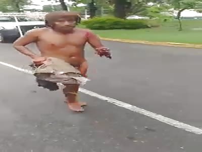 JUST A MAN WALKING NAKED, ARM EATEN BY A CROCODILE