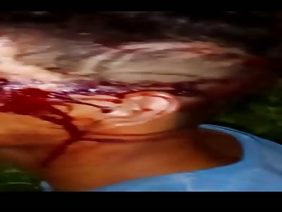 KILLED AND INJURED THIEVES