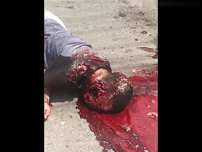 TWO GUYS WITH HEADS BLOWN UP BY SHOTS