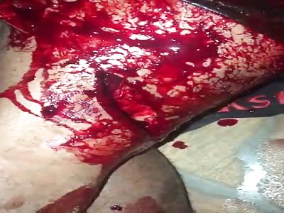 DYNG MAN AFTER BEING SLICED BY MACHETE