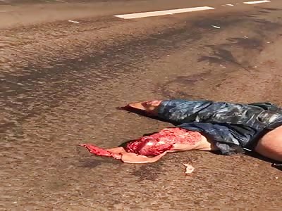 SHOCKING AFTERMATH OF MOTORCYCLE ACCIDENT 