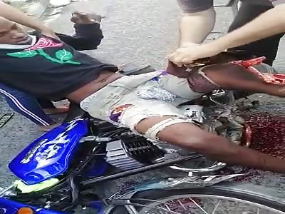 TOURNIQUET FOR A LEG IN POOR CONDITION