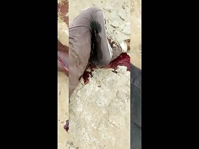 HE'S TOTTALY FUCKED UP 