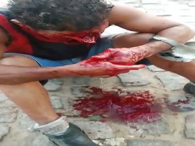 MACHETE ATTACK LEAVES MAN DISFIGURED