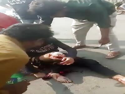 SAY GOODBYE TO YOUR KNEE, DUDE