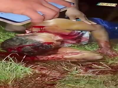 MAN INJURED BY MACHETE