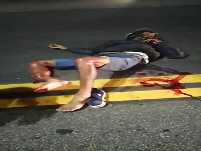 MAN IN SHOCK AFTER MOTORCYCLE ACCIDENT 