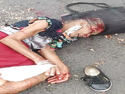 ELDERLY WOMAN IN PAIN AFTER BEING RUNOVER
