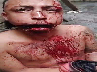 SWOLLEN FROM SO MUCH BEATING