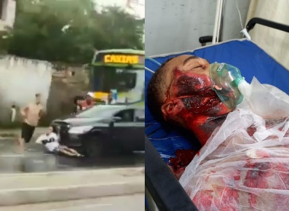 RUNOVER AND DRAGGED BY CAR- WITH AFTERMATH 