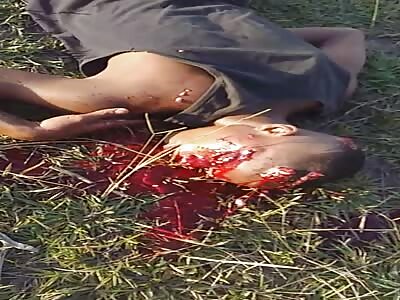 HE WAS SHOT IN THE HEAD