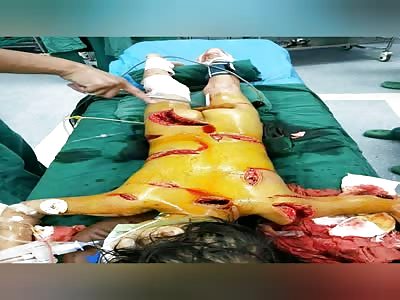 Father in Chongqingâ€™s Qianjiang District cuts his biological daughter