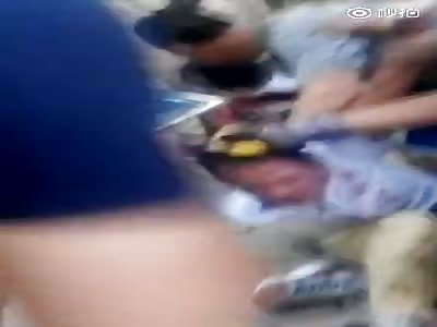 Man slaps robber with knife who slices victim in Throat.