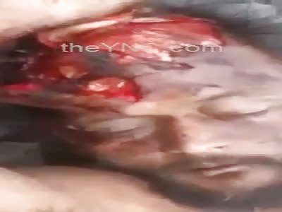 Man Still Agonizing after Jump in Front of the Train