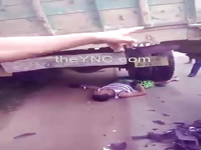 Motociclyst Leg Crushed By Truck