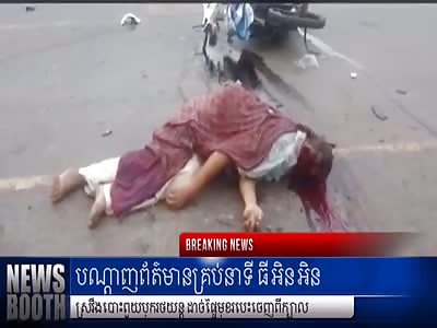 Motorcyclist Loses Face in Collision with Truck 