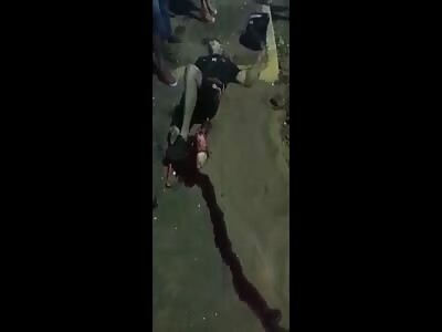 Dude Shows Us His Brutal Trauma