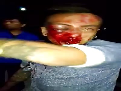  grafireto beaten  He just wanted to be an artist