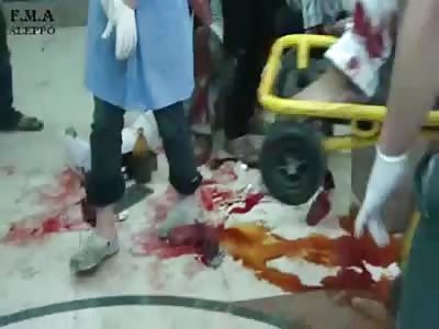 Man with mutilated foot