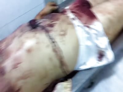 Corpses after being incinerated