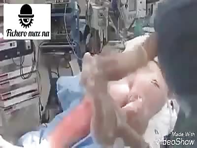 Treatment of third degree burns