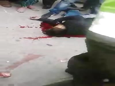 Motorcycle rider agonizing