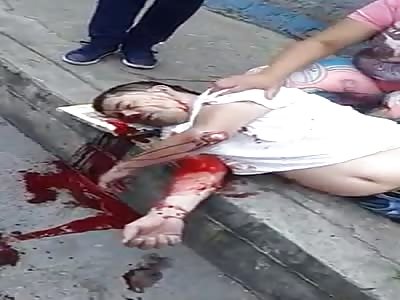 Man Agonizes After Motorcycle Accident