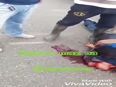 Young man with arm amputated after accident