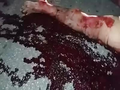 Agonizing after an accident