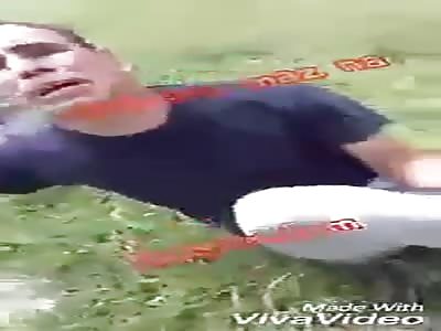 Loses foot in motorcycle accident