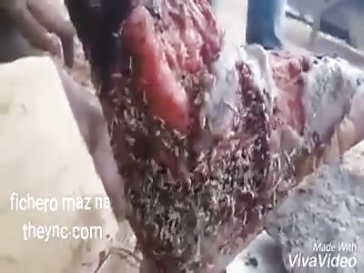 Indigent with feet infected with worms