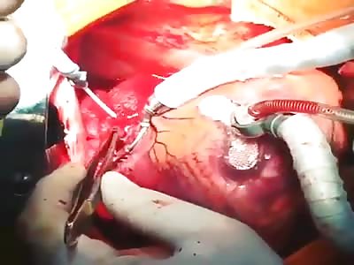 Teaching my wife how my heart beats for her (I'm a romantic)